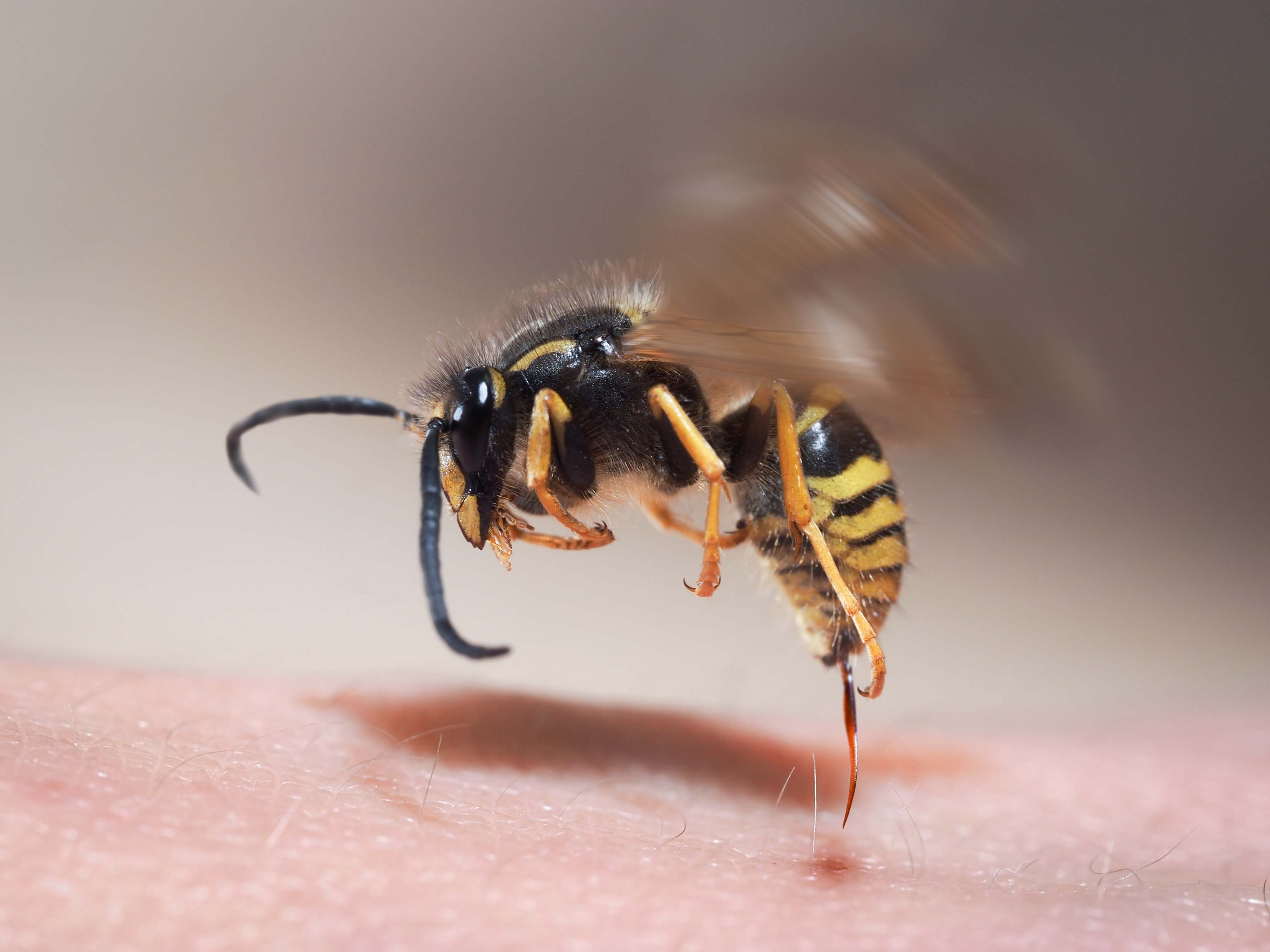 Wasp control Sydney - A wasp sting can really hurt.